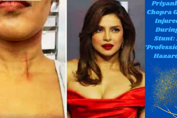 Priyanka Chopra Gets Injured During Stunt