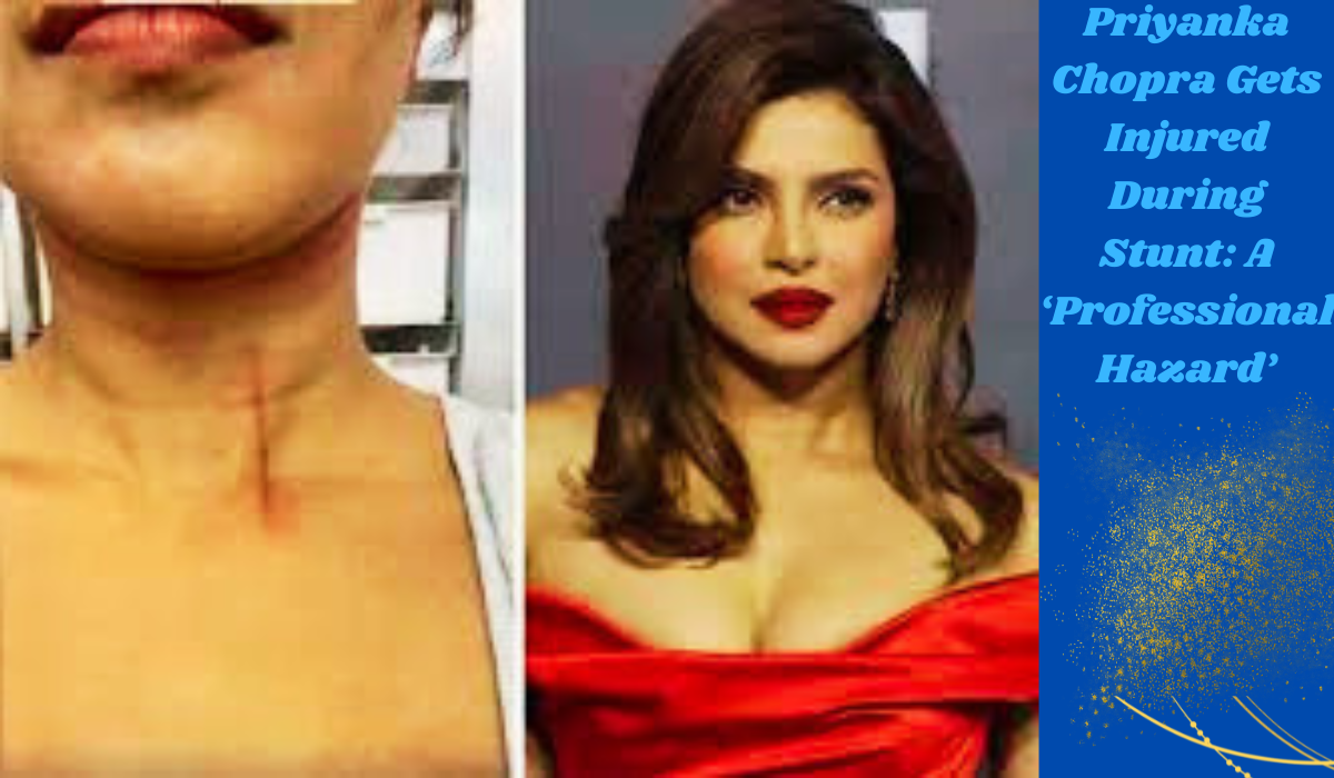 Priyanka Chopra Gets Injured During Stunt