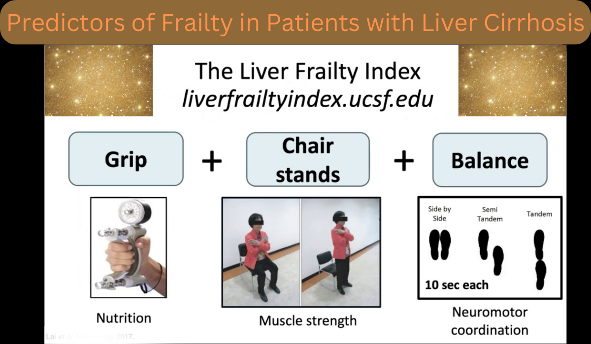 Predictors of Frailty in Patients with Liver Cirrhosis