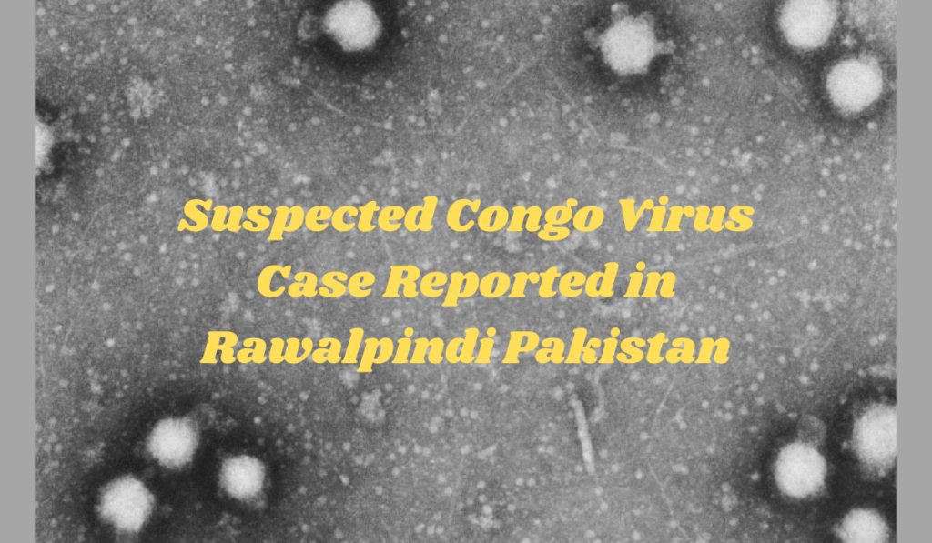 Suspected Congo Virus Case Reported in Rawalpindi