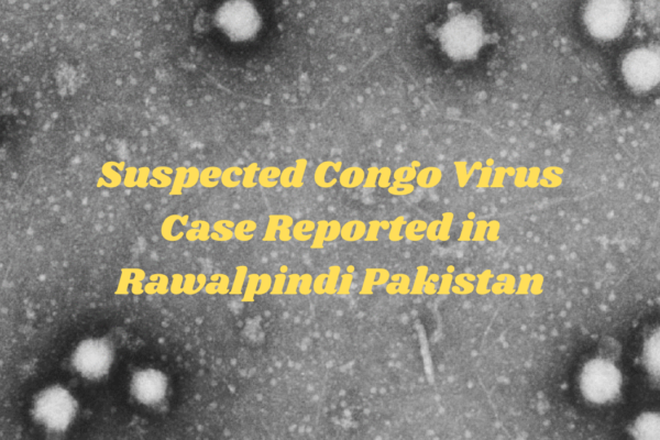 Suspected Congo Virus Case Reported in Rawalpindi