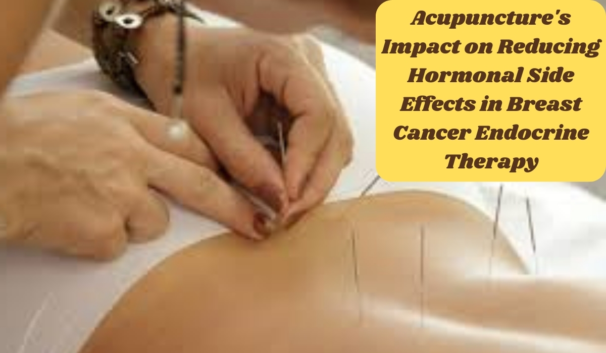 Acupuncture's Impact on Reducing Hormonal Side Effects in Breast Cancer