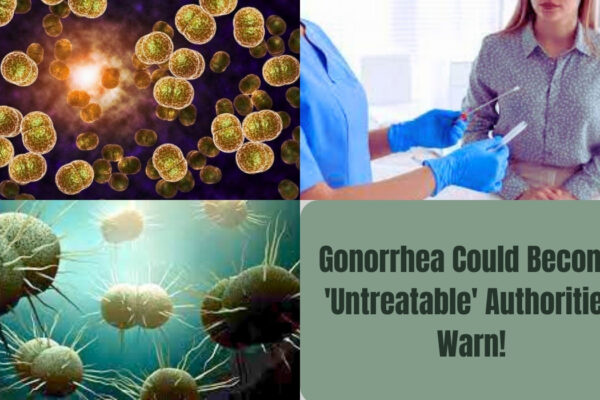 Gonorrhea Could Become 'Untreatable', Authorities Warn