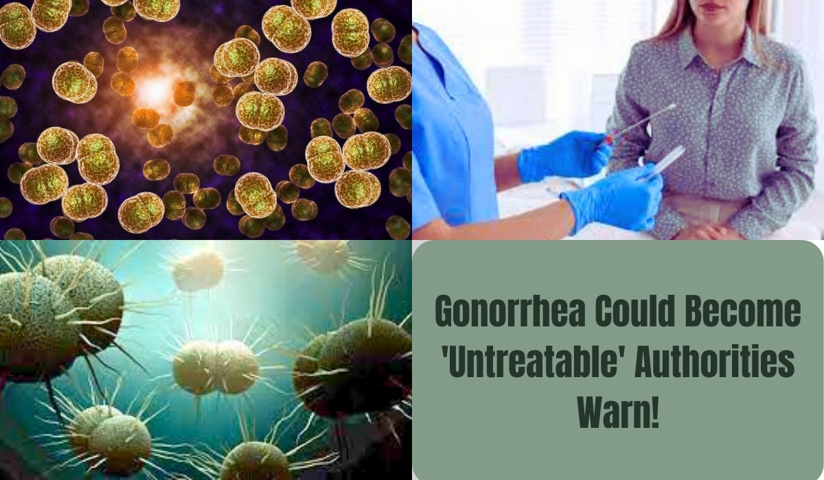 Gonorrhea Could Become 'Untreatable', Authorities Warn