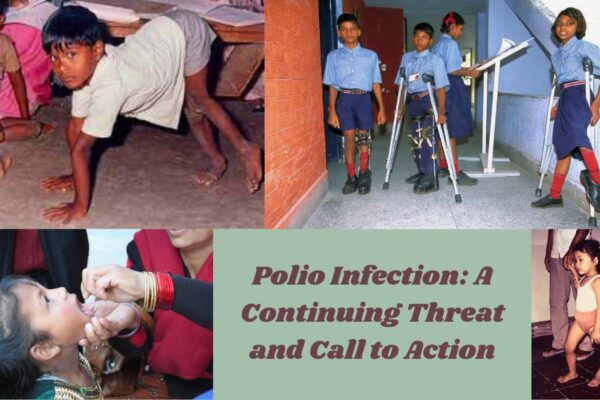 Polio Infection A Continuing Threat and Call to Action